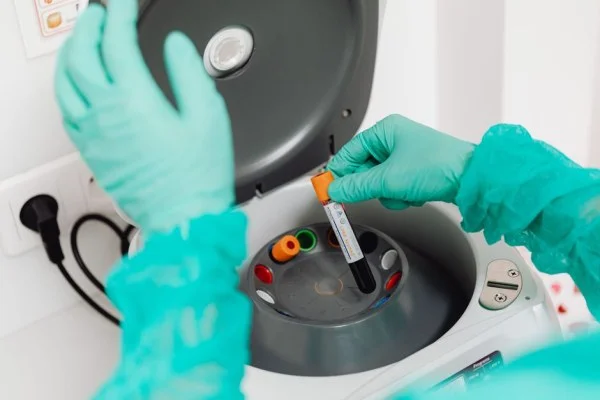 medical laboratory test sample